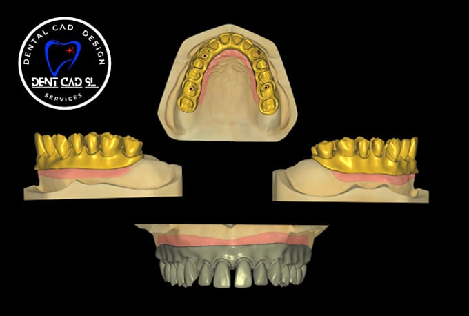 design dental design with exocad software for you