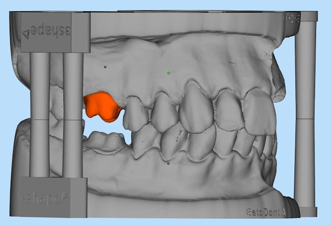 design dental appliances for you using exocad and 3shape software