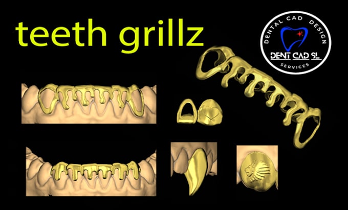 design custom tooth grills designs using exocad