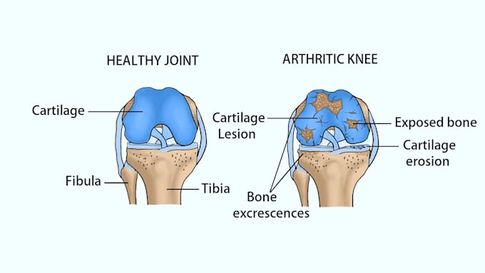 create personalized high quality medical illustrations