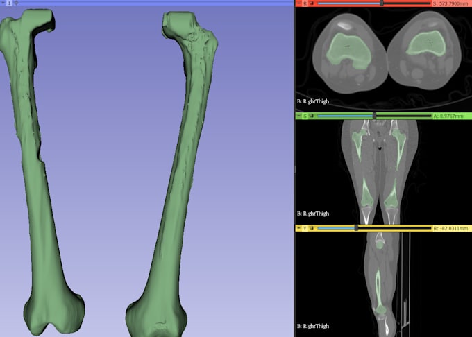 make 3d human anatomical models