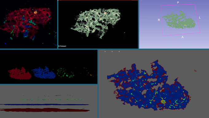 do 3d model from mri, xray, ct scan and electron microscope images