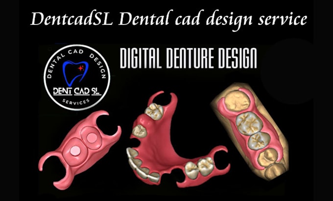 Design high quality dentures using exocad by Dentcadsl | Fiverr