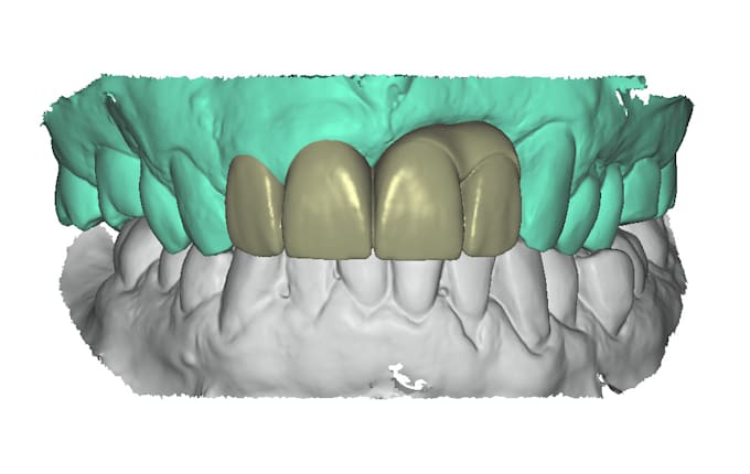 design expert dental cad cam works