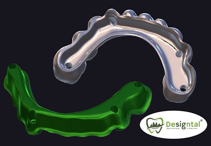 do master crafted dental design for hybridbridge with b4d ibar