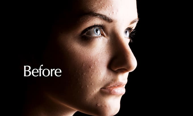 remove acne and blemishes from photos