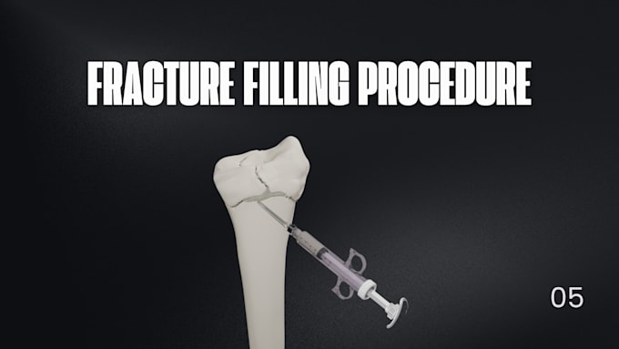 create expert 3d design, animation and renders for your medical device