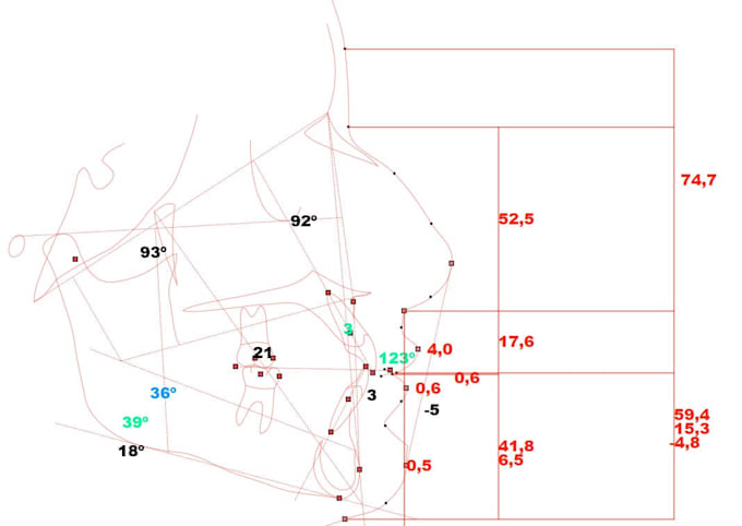 perform orthodontic cephalometric analysis