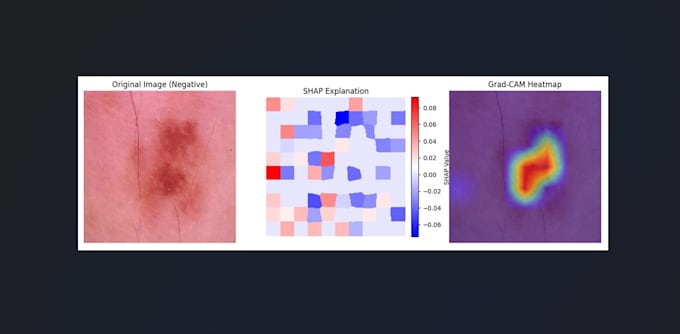 do explainable ai based deep learning projects