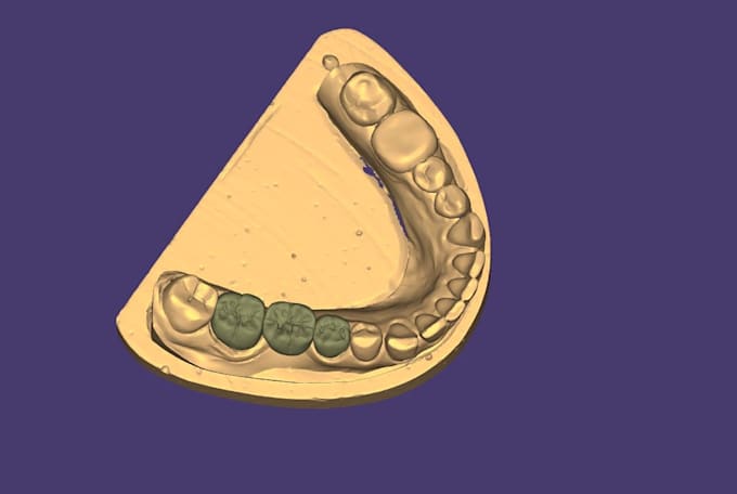 design crowns and bridges