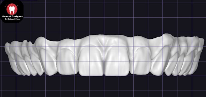 Do cad cam dental designer by Drmohamed99 | Fiverr