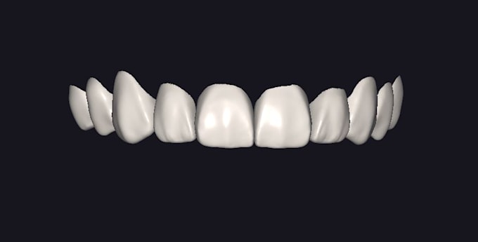 design 3d printed and milled veneers
