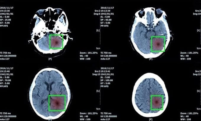 do medical imaging processing with ml, dl, computer vision