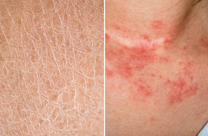 skincare second opinion by MD