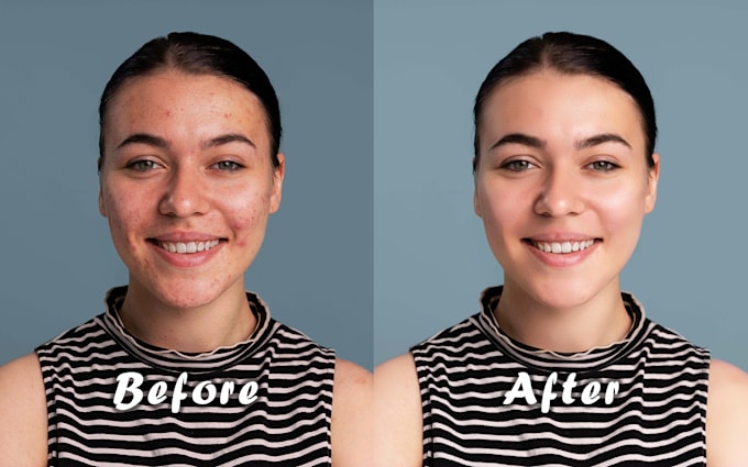 retouch and remove wrinkles, acne, scars and more for a flawless, natural look
