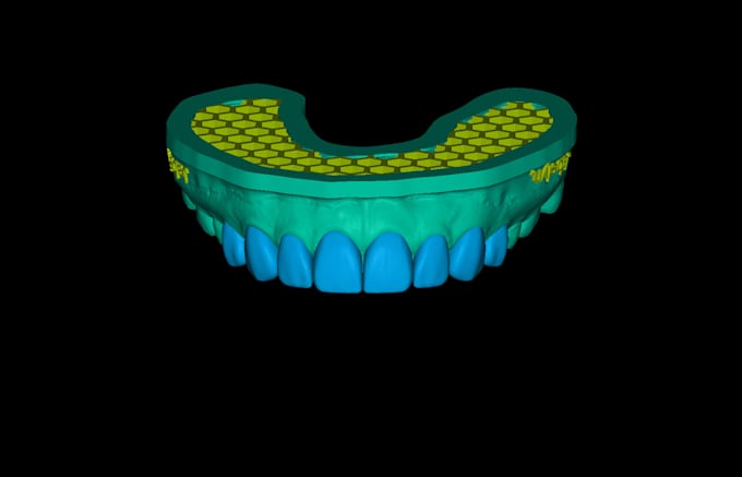 design dental waxup dsd using exocad