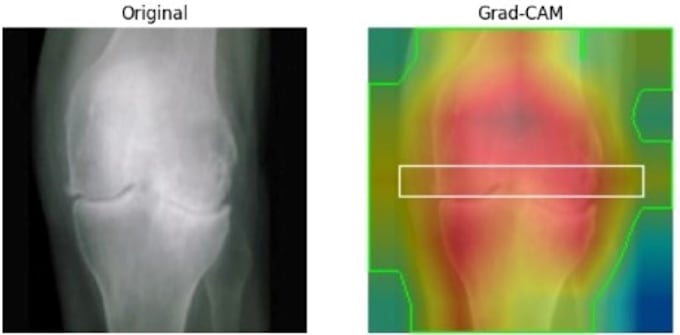 do medical imaging ai for disease classification by grad cam mri xray radiology