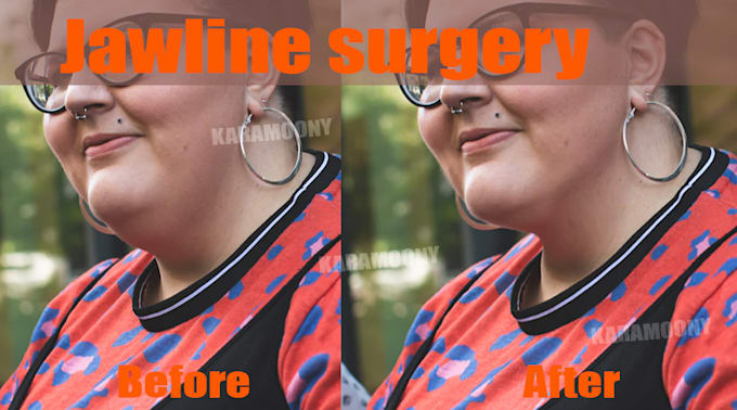 do jawline, slimmer face, chin surgery simulation