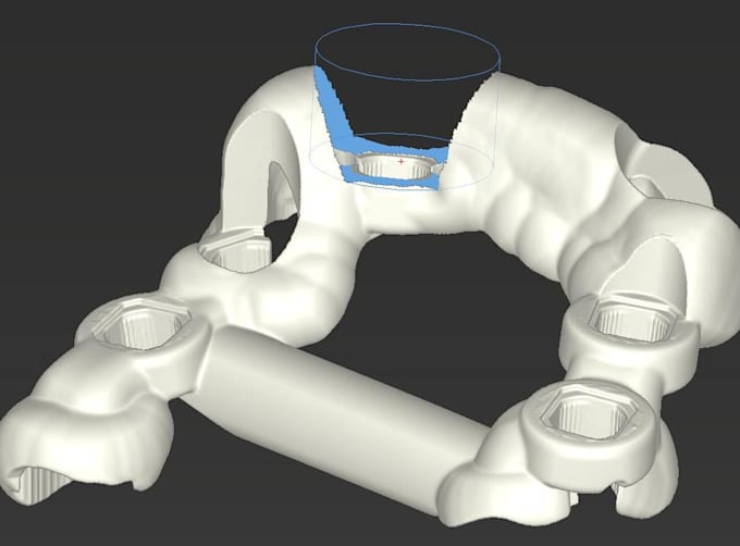 create dental implant planning and digital surgical guides using codiagnostix
