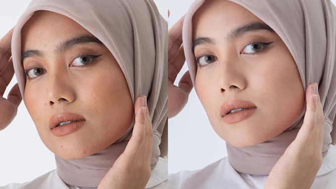 retouch skin and remove the red vein