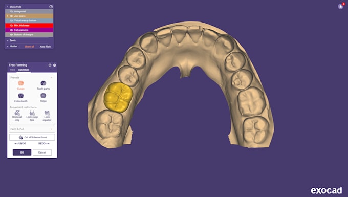 design crowns, bridges, using exocad