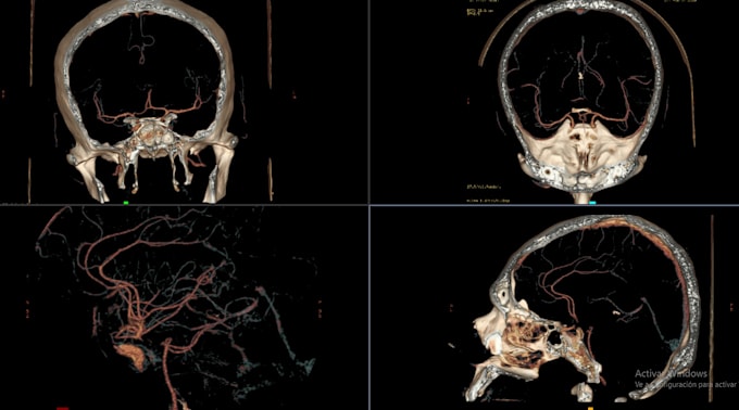 process your radiology study according to your specifications