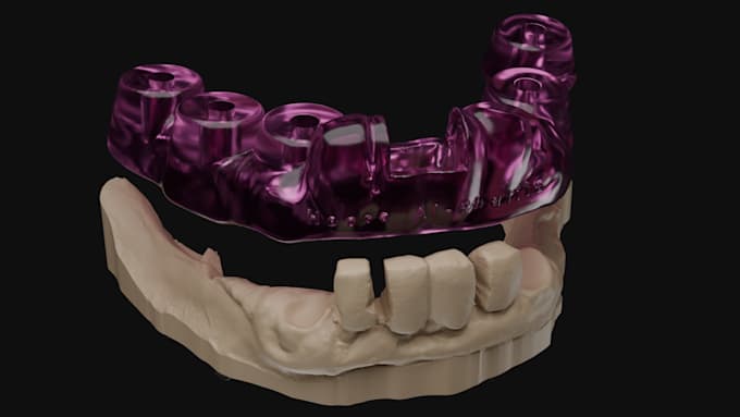 design precise surgical guide
