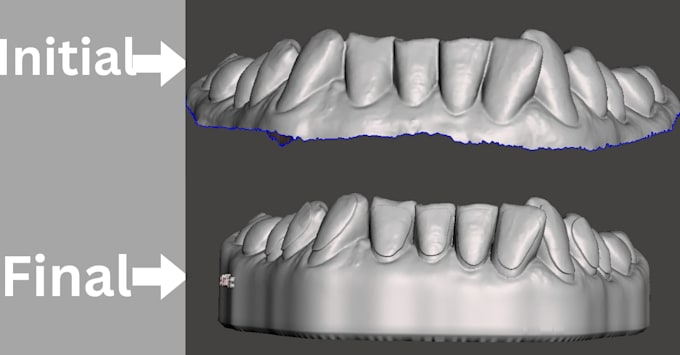 clear bleaching trays and mash stls