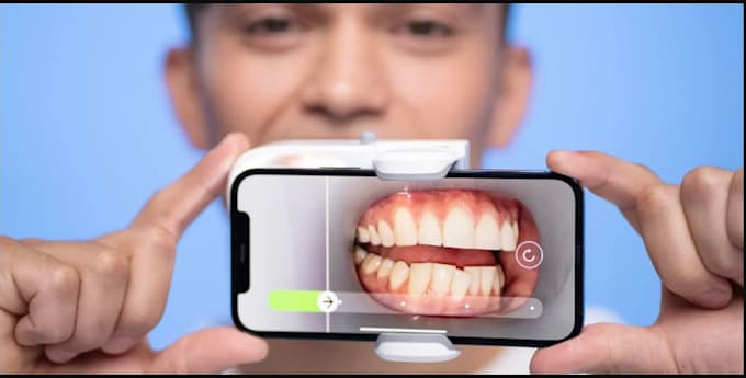 3d scanning app, dental scanning app, medical scanning app
