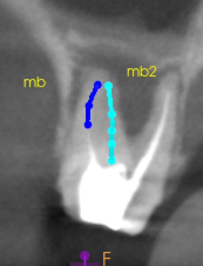 provide professional cbct radiology reporting