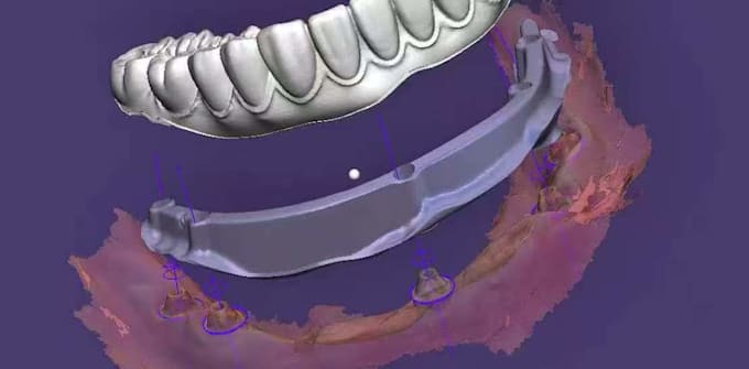 install exocad and 3shape dental software remotely