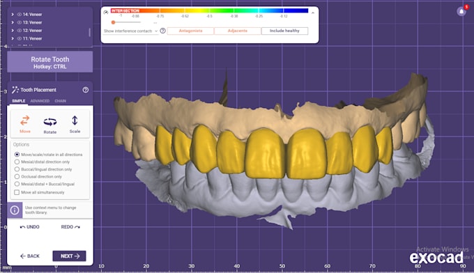 design crowns and bridges using exocad