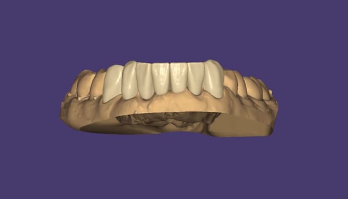 design dental prosthetic solutions