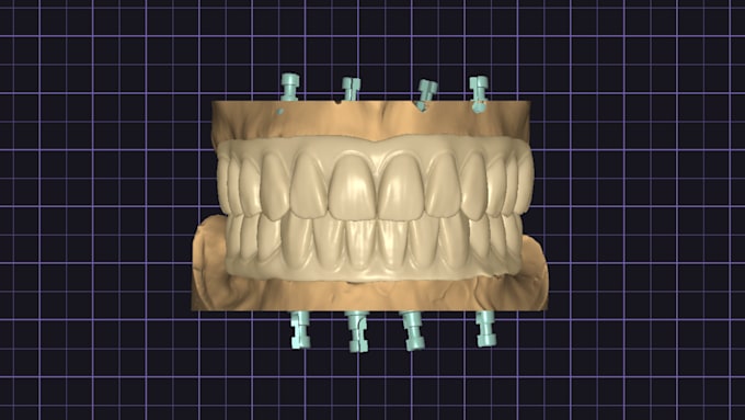 dental design for your job