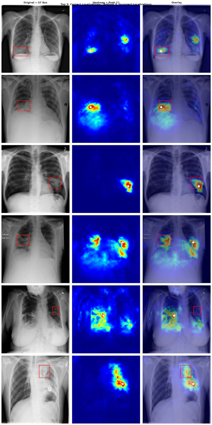 build deep learning models for medical image disease detection