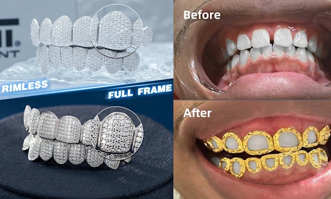 design any high end custom grillz in 3d cad