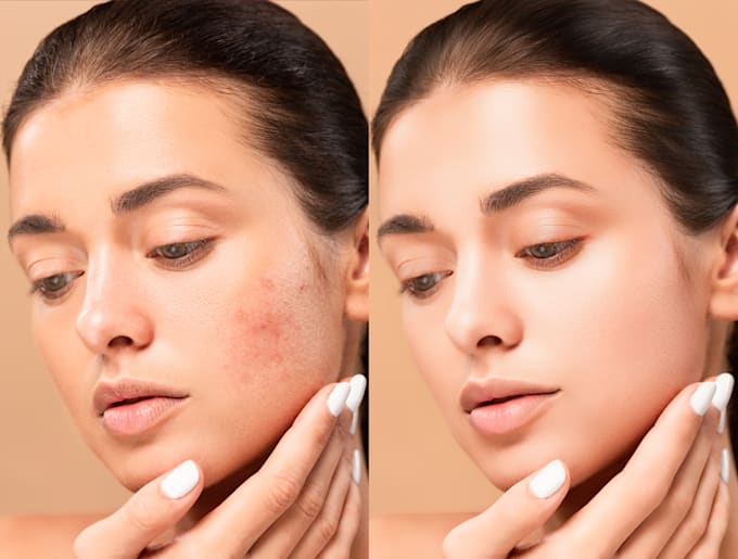 edit your beauty images