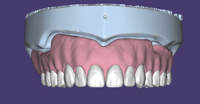 design precise full dentures using exocad