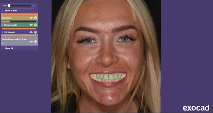 design professional exocad dental cad restorations