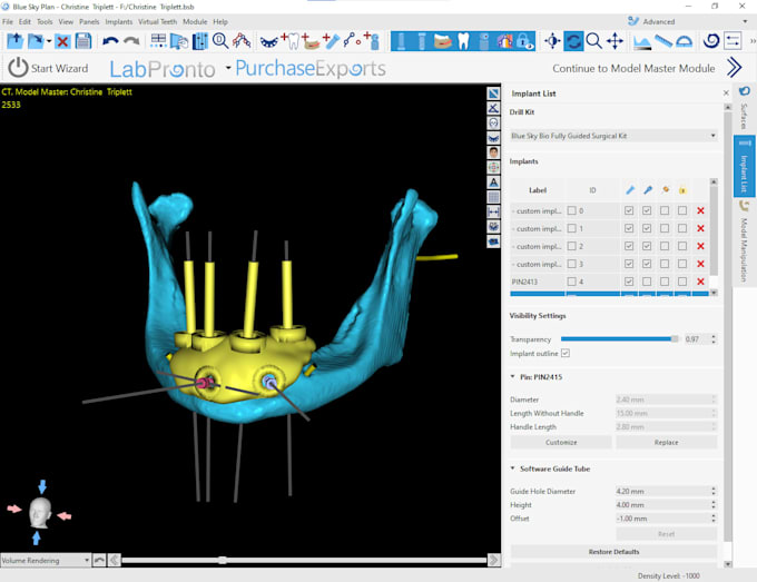 do implant planning ,surgical guide using blue sky and b4d