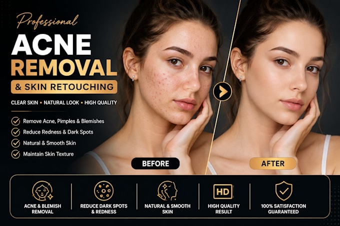 remove pimples, acne, scars and skin blemishes
