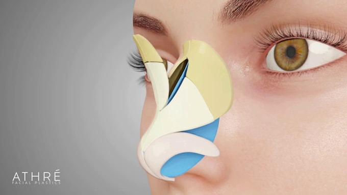 create realistic 3d medical animation, surgical procedure, anatomy visualization