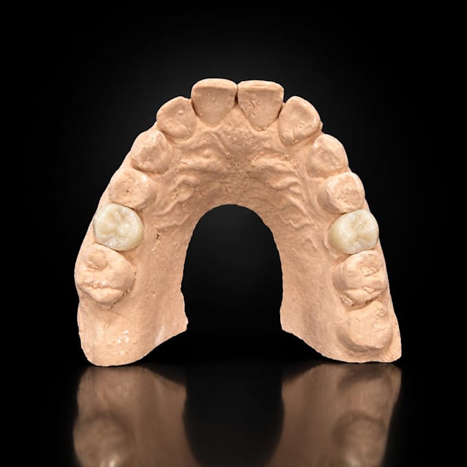 create professional dental cad designs in exocad