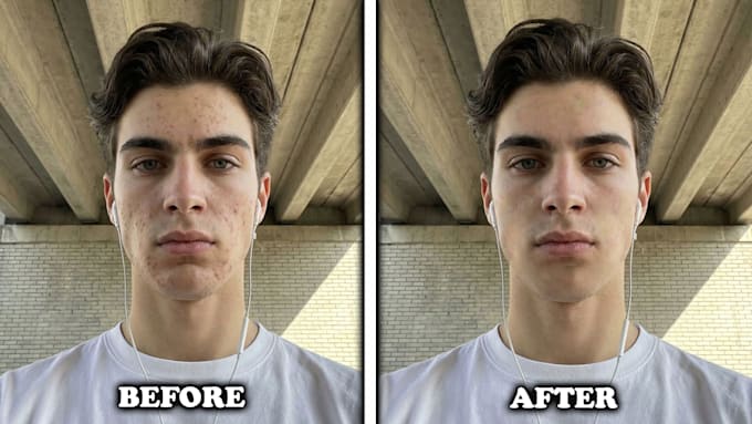 remove pimples and blemishes