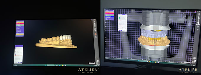 design dental crowns,bridges and implants as exocad expert