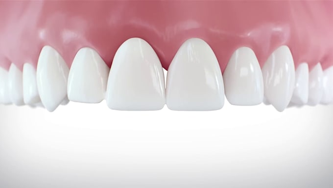create realistic 3d dental animation for implants and procedures animation