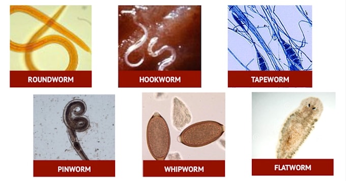 Parasite Cleanse >> Parasite Cleanse Advice And Help By Chimoney330 Parasite Cleanse >> Parasite Cleanse Advice And Help By Chimoney330