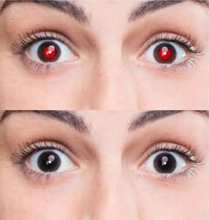 Remove Red Eye Into Normal Eye By Shahzadali811