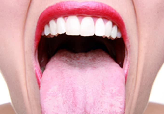 do-an-authentic-traditional-chinese-medicine-tongue-diagnosis-by-lancei