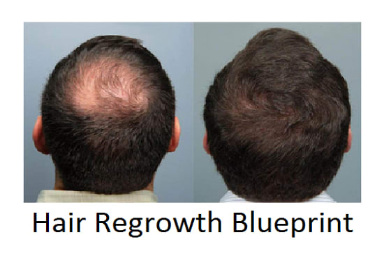 Help You Stop Your Hair Loss And Regrow Hair Naturally By